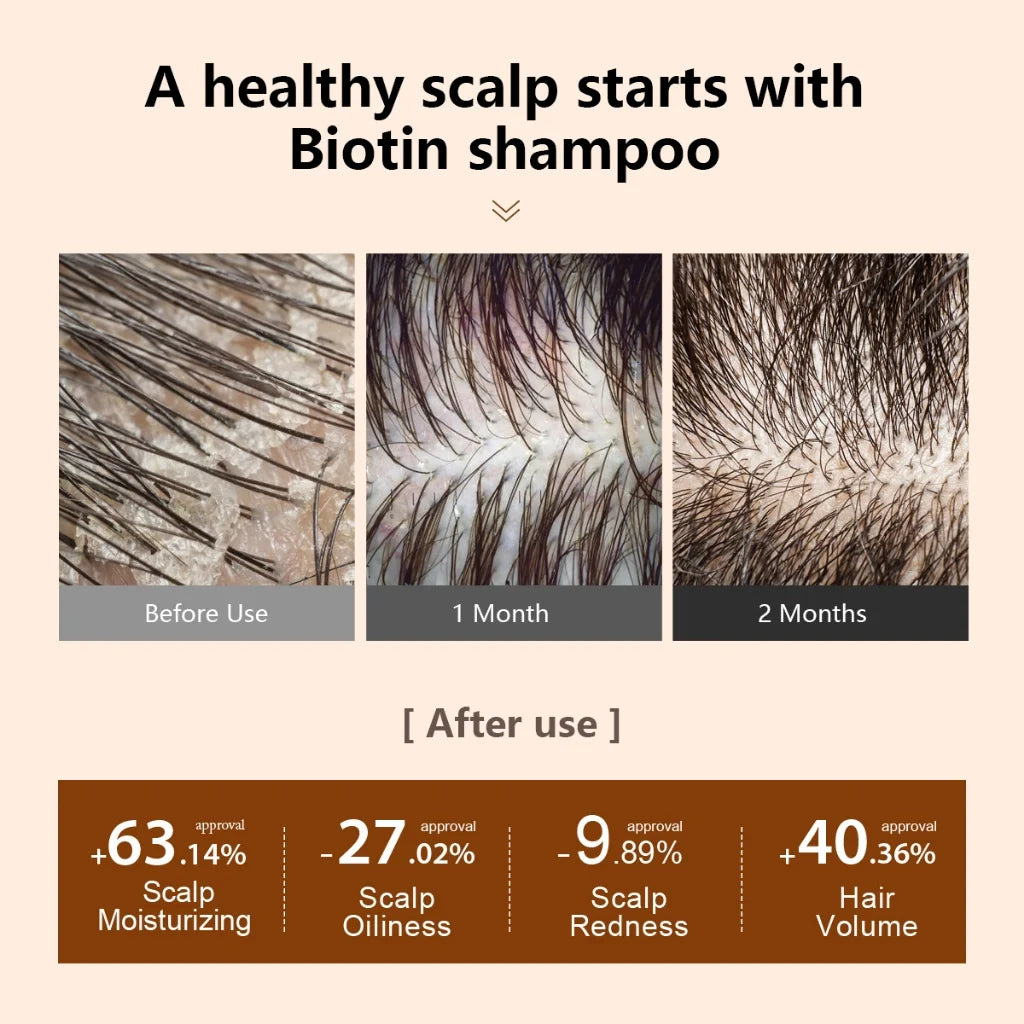 PURC Biotin Hair Care Set: O Segredo para Cabelos Saudáveis e Radiantes